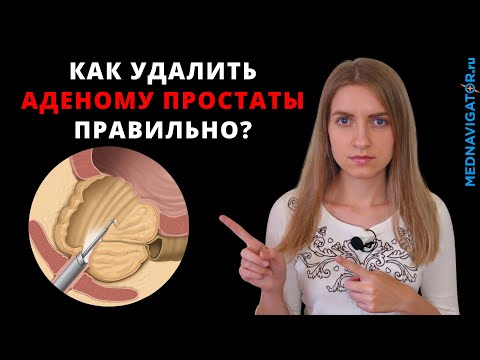 Операция удаления АДЕНОМЫ ПРОСТАТЫ: ТУР, ЛАЗЕРНАЯ ЭНУКЛЕАЦИЯ, АБЛЯЦИЯ, ВАПОРИЗАЦИЯ | Mednavigator.ru