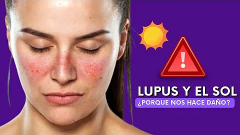 ¿Por qué el sol empeora el lupus?