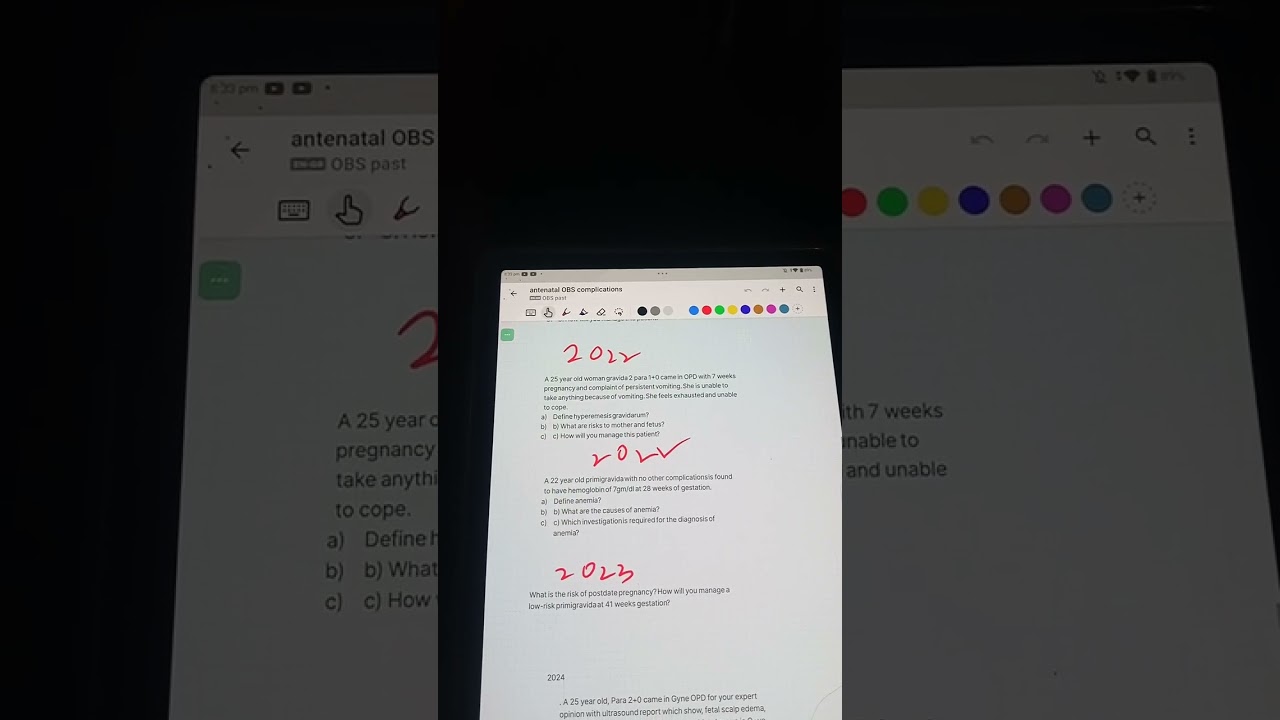 Ch 8 pt 2 , antenatal obstetric complications,obstetrics, Irfan Masood quick review