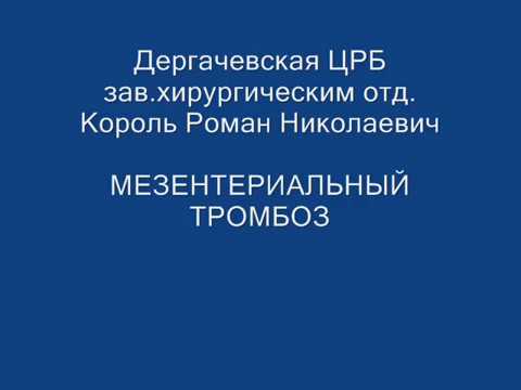 Мезентериальный тромбоз Дергачевская ЦРБ