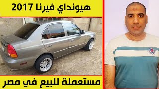 هيونداي فيرنا 2017 مستعملة للبيع في مصر فبريكة بالكامل بدون دهان فيها رخصة سنة وشهر و 60 الف كيلو