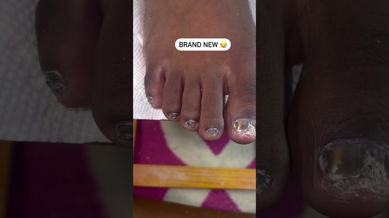 Have you tried polygel toes yet 🤔‼️ 