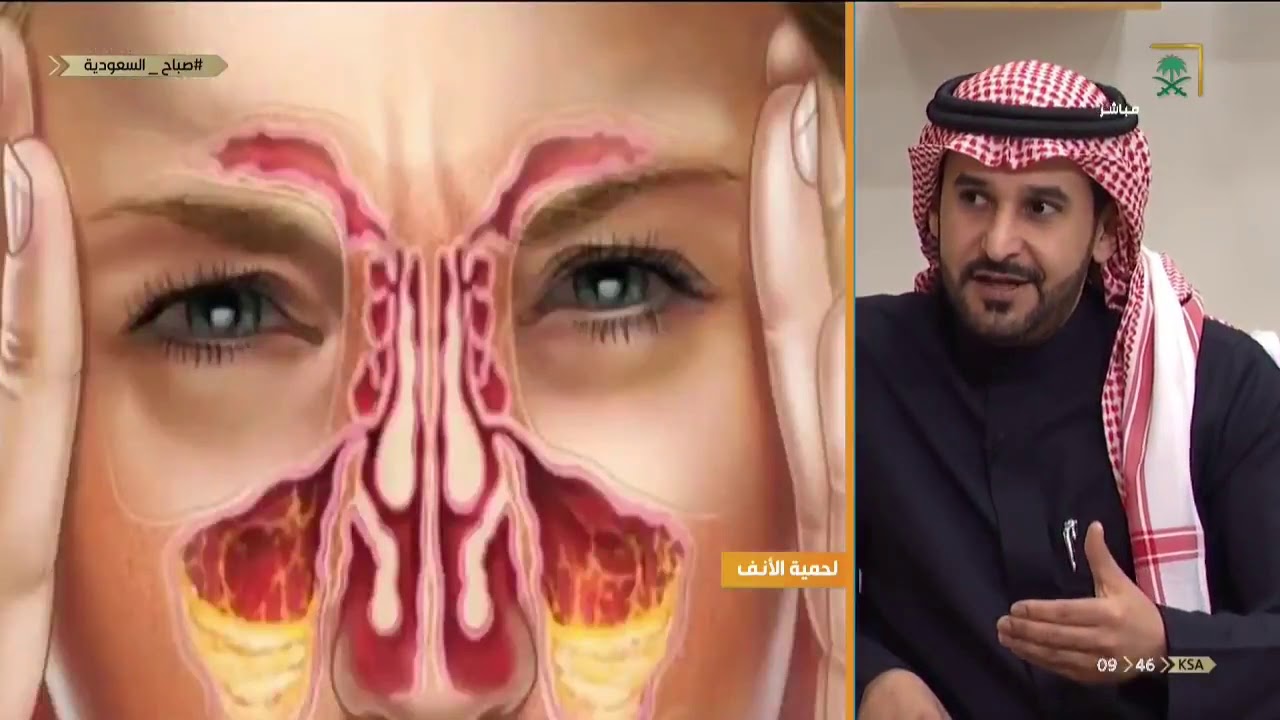 ماهي لحمية الأنف وأنواعها ؟ مع د. يزيد الغنيم - استشاري جراحة الوجه  التجميلة - YouTube