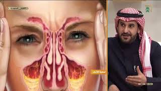 ماهي لحمية الأنف وأنواعها ؟ مع د. يزيد الغنيم - استشاري جراحة الوجه التجميلة