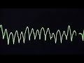 Cardiac arrest rhythms, VF, VT, Asystole and PEA