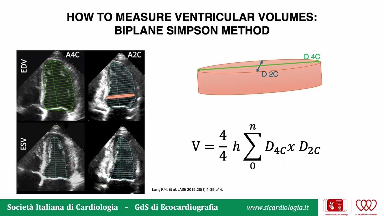 Valutazione ecocardiografica della frazione di eiezione del ventricolo sinistro