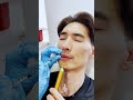 Male Botox Patient Reaction