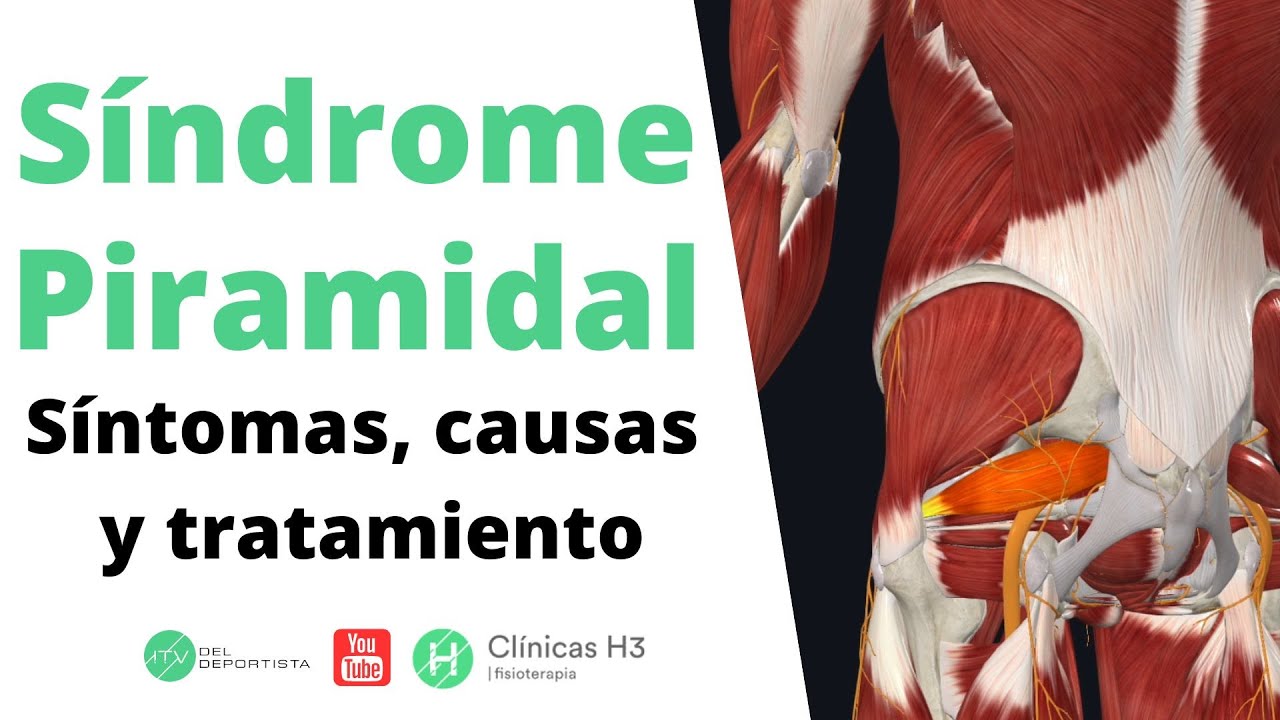 Síndrome piramidal dolor ingle. ✅Tratamiento síndrome piramidal | Clínicas H3