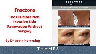 Fractora Video