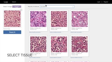 Introduction to Luigi (Large Scale HistoPathological Image Retrieval System)