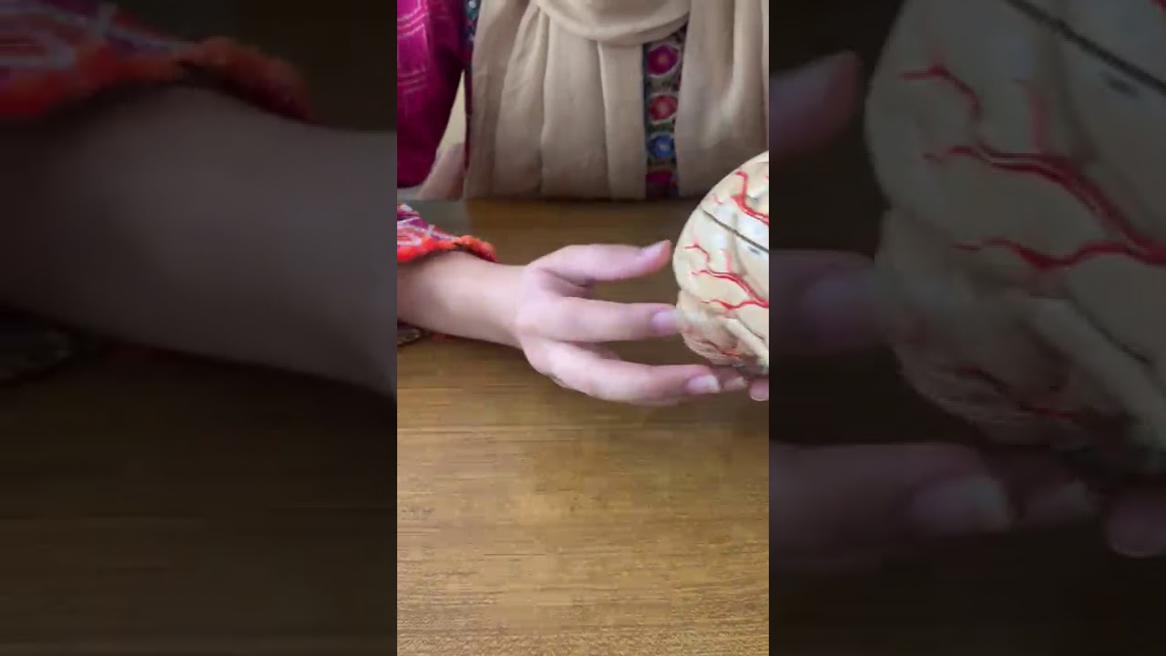 Superior Surface of Brain : Gyrus and Sulcus _ Model Description