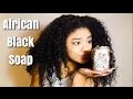 How To Use African Black Soap To Remove Acne, Pimples And Scars