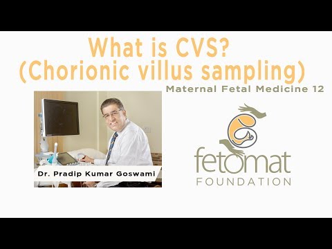 fetal doppler cvs