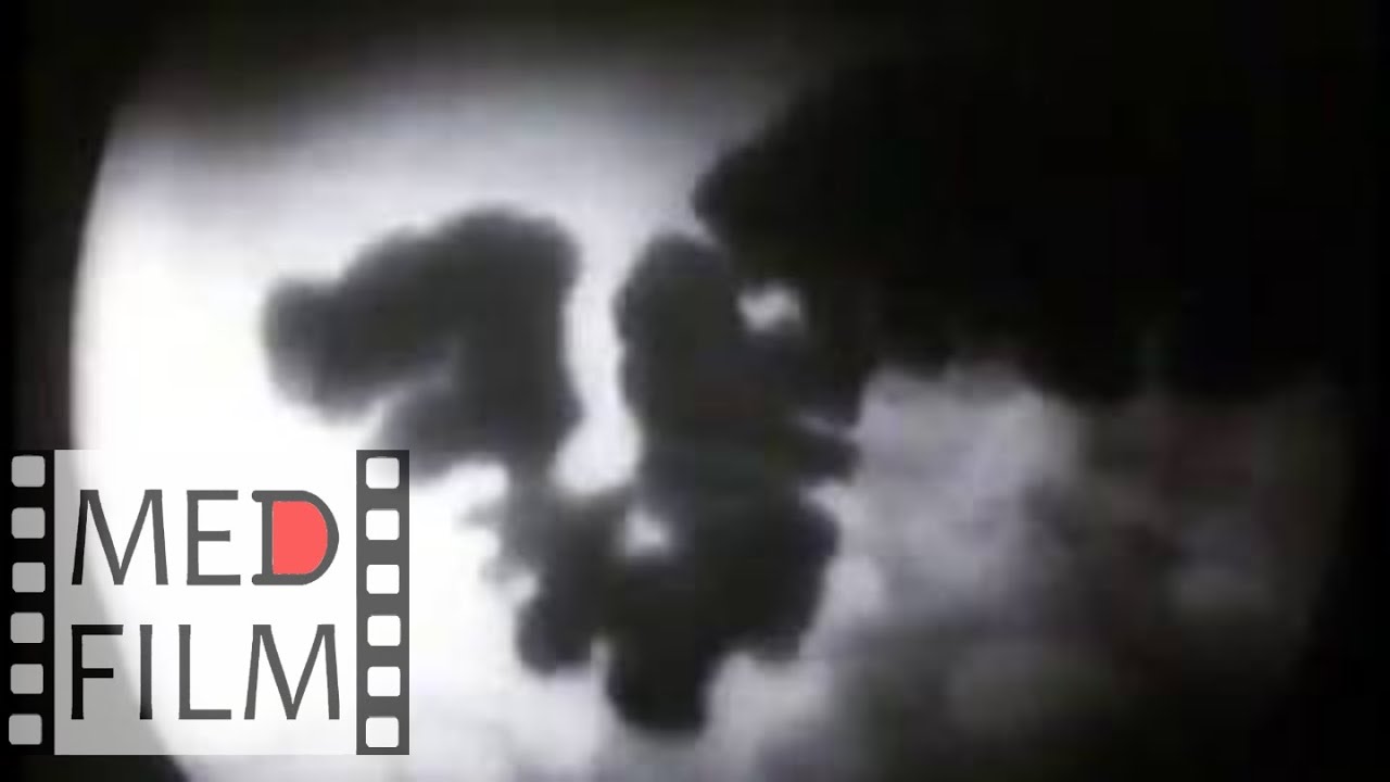 Рентгенологическое исследование кишечника © X-ray study of the intestine