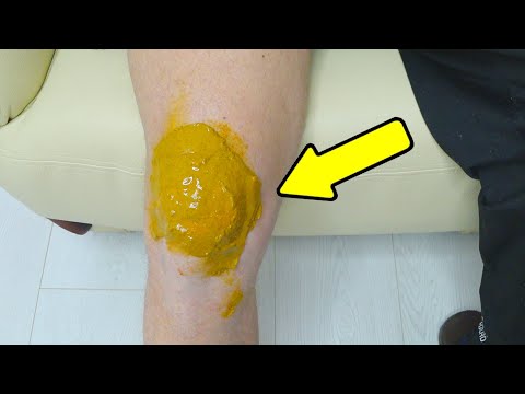 Боль в колене и суставах уйдет СЕГОДНЯ ! Срочно приложите это средство!!!
