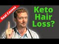 Hair Loss on KETO (Are the Rumors True?) 2021