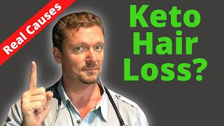 Hair Loss on KETO/Carnivore (Are the Rumors True?) 2026