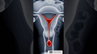 HSG Test Procedure | Fallopian Tube BlockageTest#HSGTest#Hysterosalpingography#InfertilityTest#Women