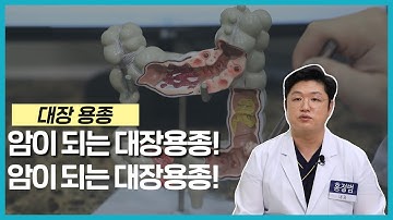 [건강365] 암이 되는 대장용종? (양산홍내과 / 홍정범 대표원장 / 055-912-1004)