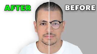 ما قبل و ما بعد النظارات 👓 👀15 DAYS AFTER