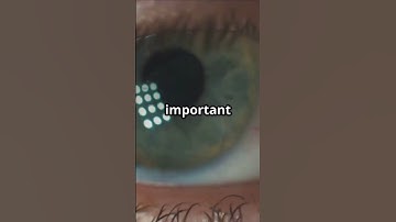 You Won’t Believe What Happens If You Never Blink for 24 Hours #shorts #shortsfeed #ytshorts