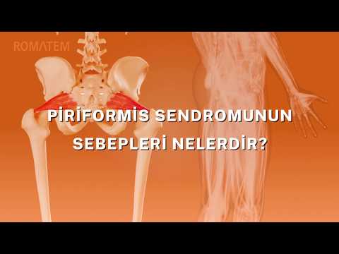 Piriformis Sendromu Romatem | Spor Yaralanmaları, Bel Ağrısı, Bacak Ağrısı, Kalça Ağrısı, Bel Fıtığı