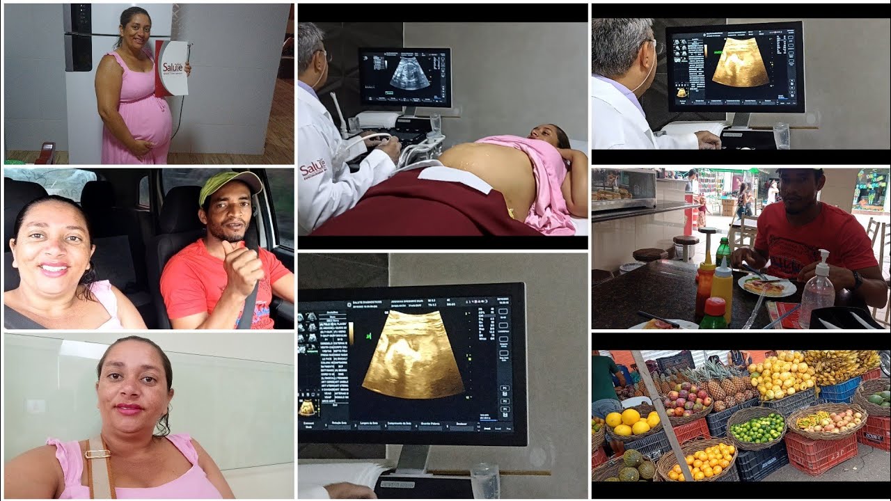 fomos-fazer-ultrassom-pra-ver-se-o-beb-j-est-encaixado-pra-nascer