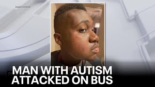 Mother speaks out after son with autism attacked on SEPTA train