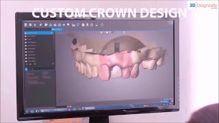 Guided Surgery and CAD/CAM Restorations By 3DDX