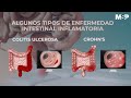 Cómo tratar las enfermedades inflamatorias del intestino