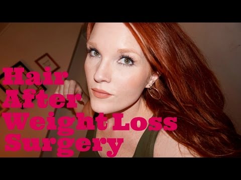Hair and Hair Loss After Weight Loss Surgery – Before and After Pics