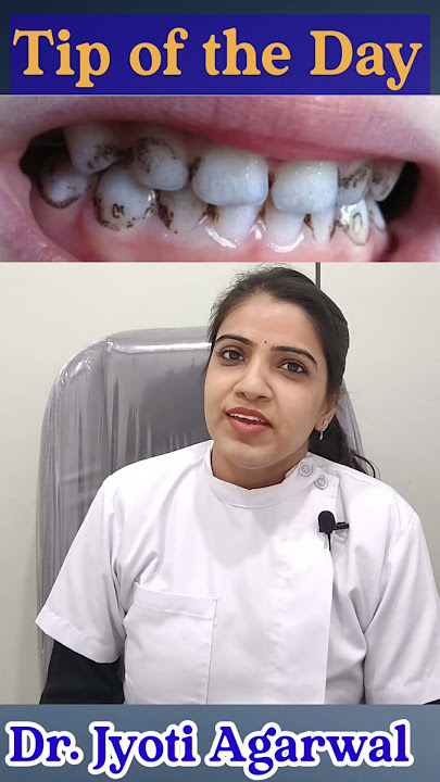 Tip of the day #18 | how to get rid of black stains on teeth caused by multivitamins