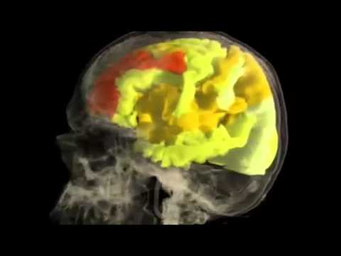 Woman's BRAIN while having an ORGASM : fMRI Scan