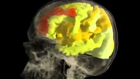 Woman's BRAIN while having an ORGASM : fMRI Scan