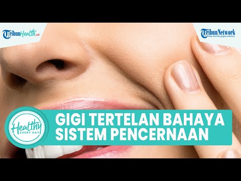 Video: 4 Cara Menghilangkan Gigi yang Tertelan