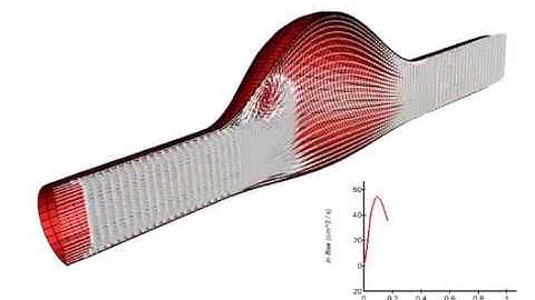 Blood flow in an abdominal aortic aneurysm