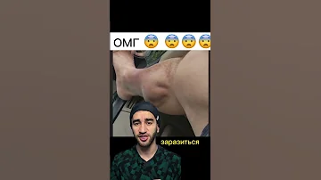 ужасные черви в ноге человека