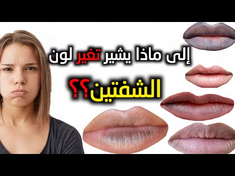 فيديو: ماذا تعني الشفاه ذات اللون الأرجواني؟