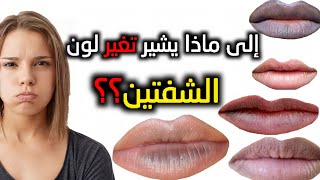 هل تعلم ما هي الأمراض التي يشير لها لون الشفتين | هناك أمراض صامتة لا تشعر بها إلا بعد فوات الأوان