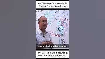 MACHINERY MURMUR In Patent Ductus Arteriosus #shortvideo #shorts #drnajeeb #lecture