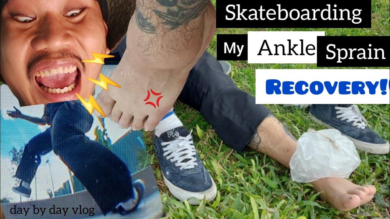 My Skateboarding Ankle Sprain Recovery 🦶 YouTube
