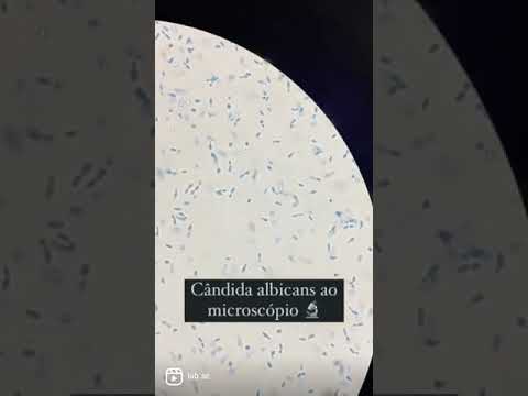 Microscopia - Candida albicans