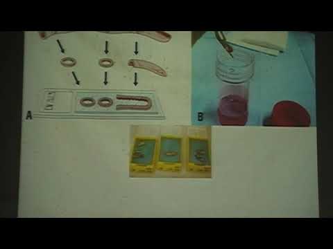 Các Kỹ Thuật Mô Bệnh Học Cơ Bản - youtube