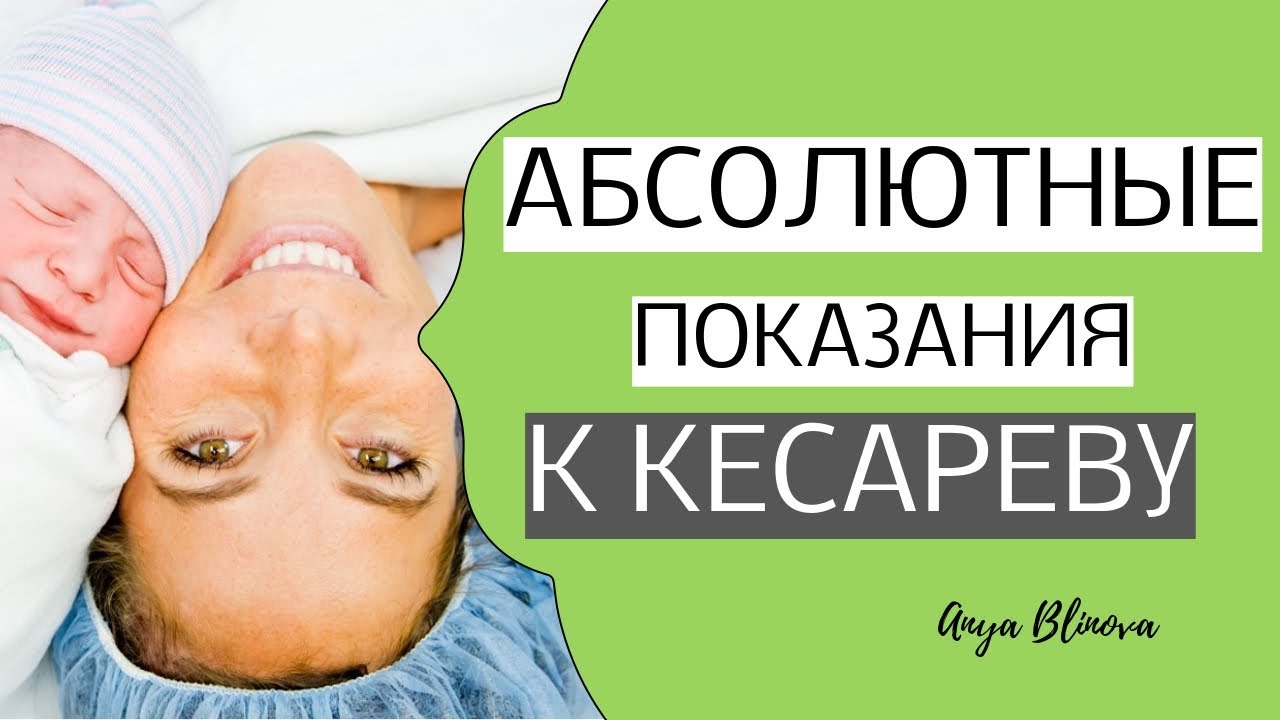 Смотреть Показания к кесареву сечению видео Смотреть Показания к кесареву сечению видео