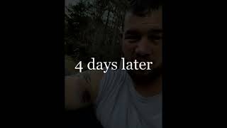 I Tore My Pec! Day 1-5 Of How It Looked #benchpress by Georgia Assassin 64 views 2 months ago 1 minute, 57 seconds