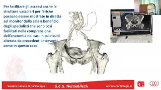 TAVI PIANIFICAZIONE E TECNICHE PROCEDURALI screenshot 5