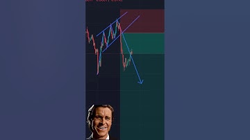 Olymp Trade Basics: Easy Strategy for Beginners! 📈💡 #OlympTrade #TradingTips #FinanceMadeSimple