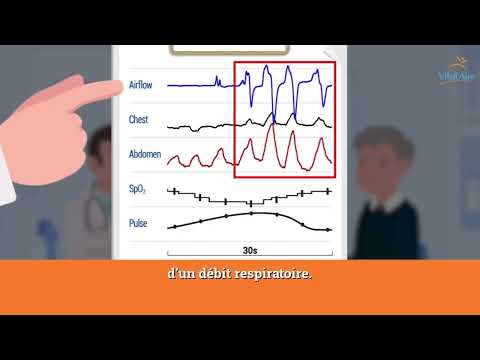 Vidéo: Comment remplir le calcul des primes d'assurance : exemple