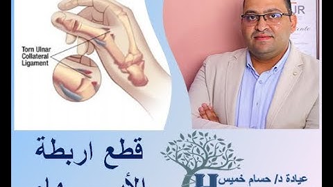 اصابة او قطع اربطة اصبع الابهام