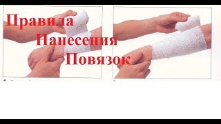 Правила наложения повязок.